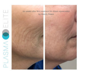 Clinical Depigmentation Treatments