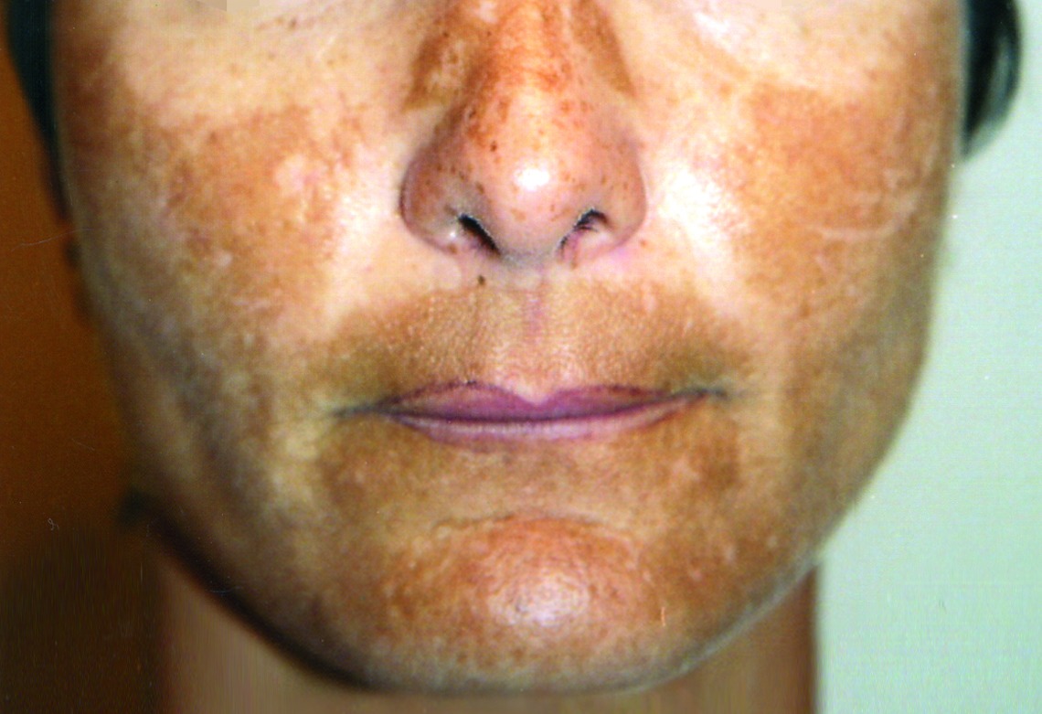 Patient 2 — before