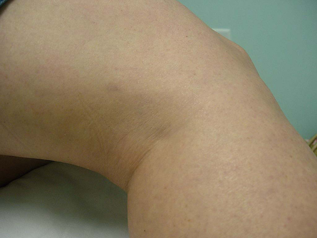 After treatment
