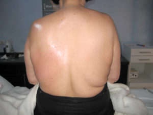Med Contour in clinic